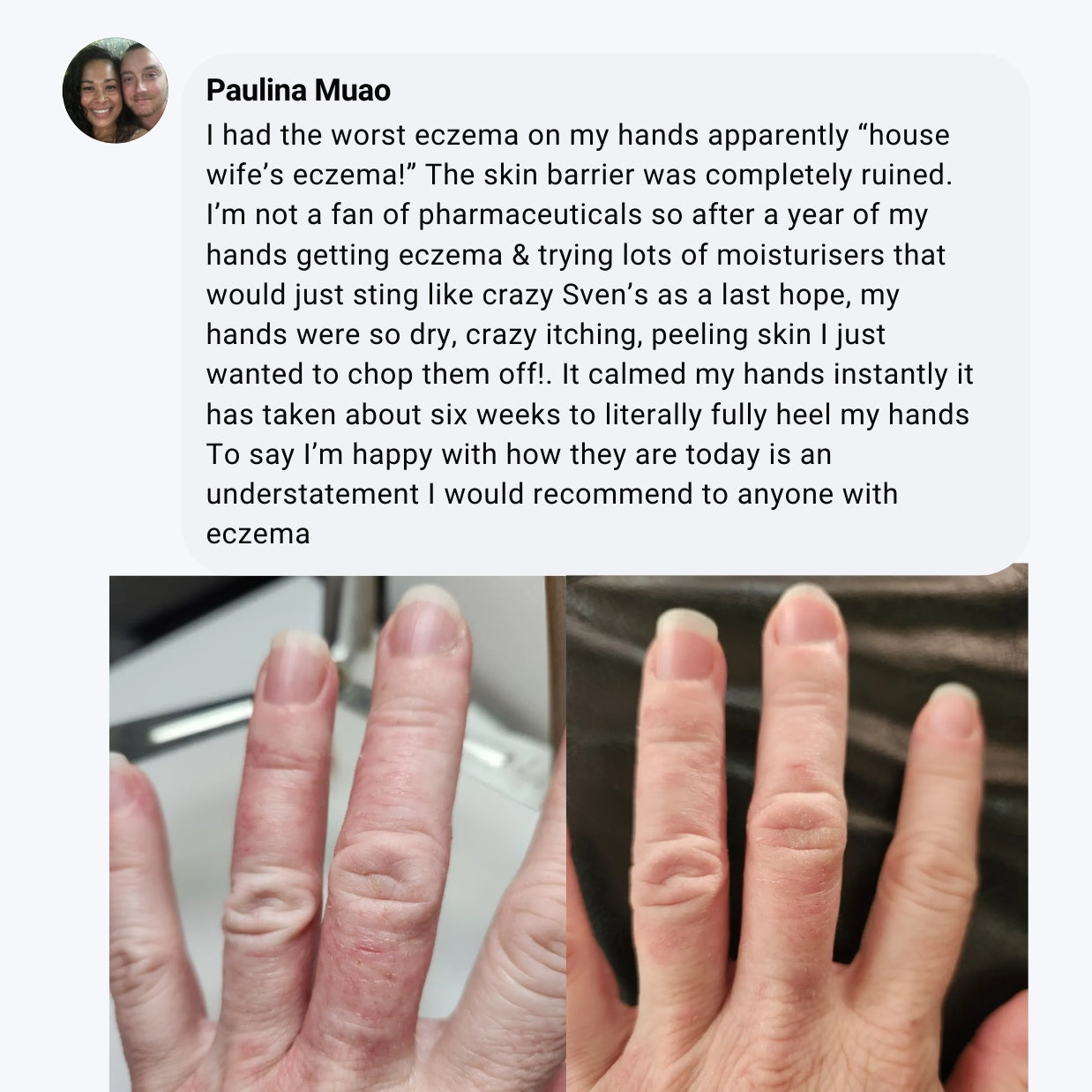 Miracle Manuka Skin Repair Ointment
