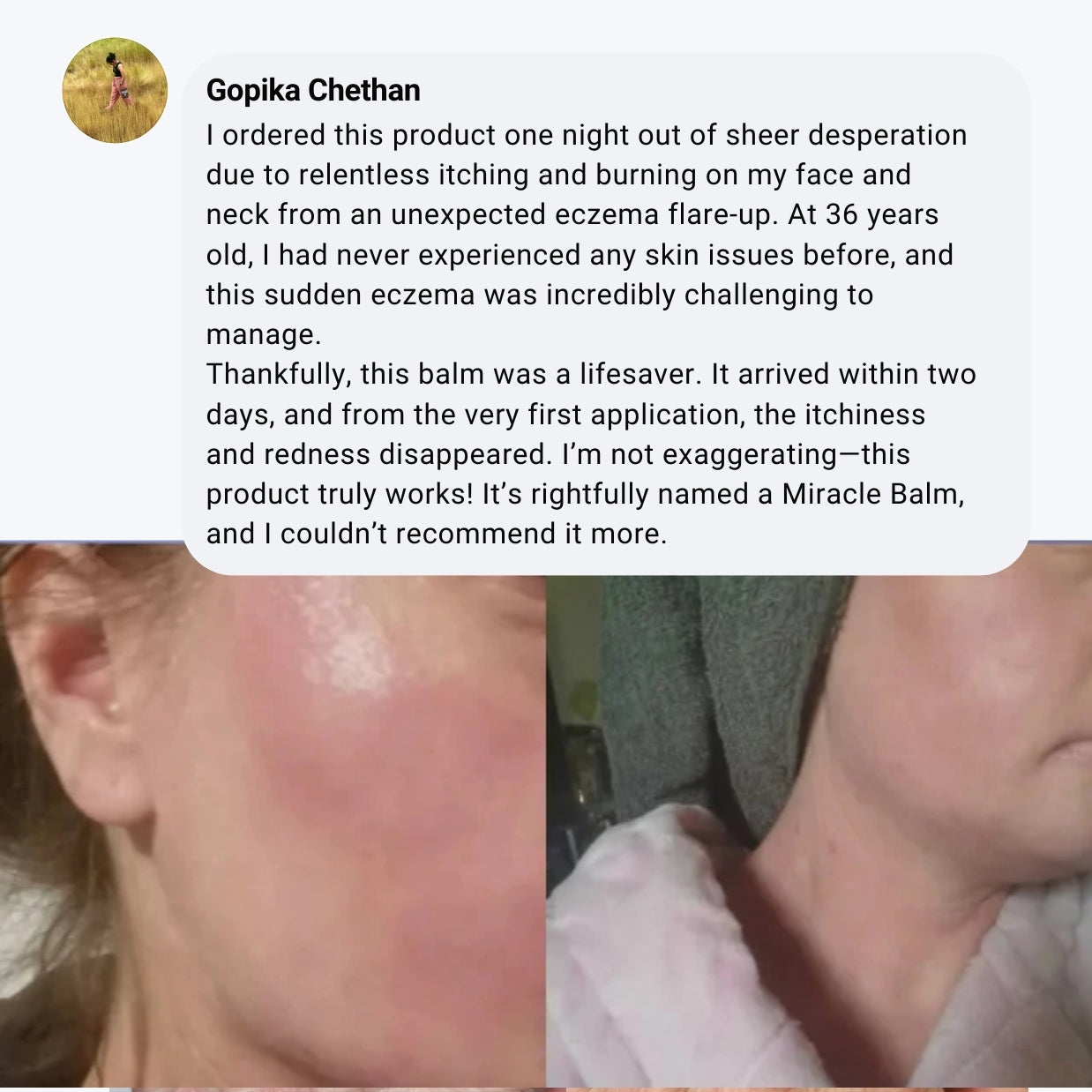 Miracle Manuka Skin Repair Ointment