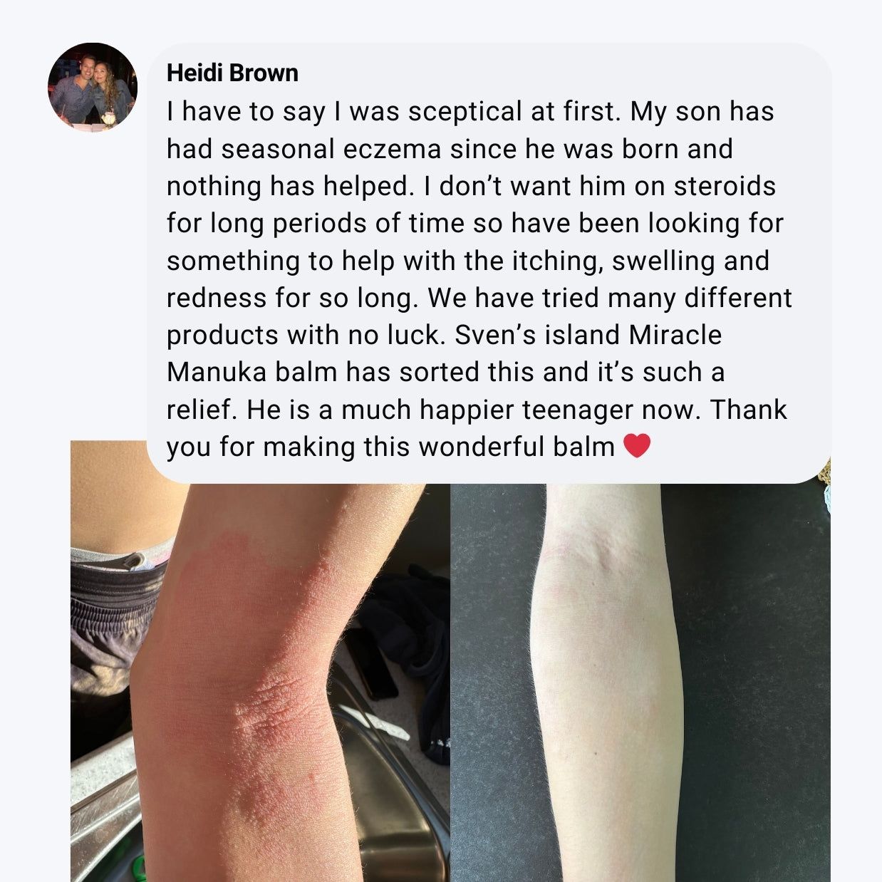 Miracle Manuka Skin Repair Ointment