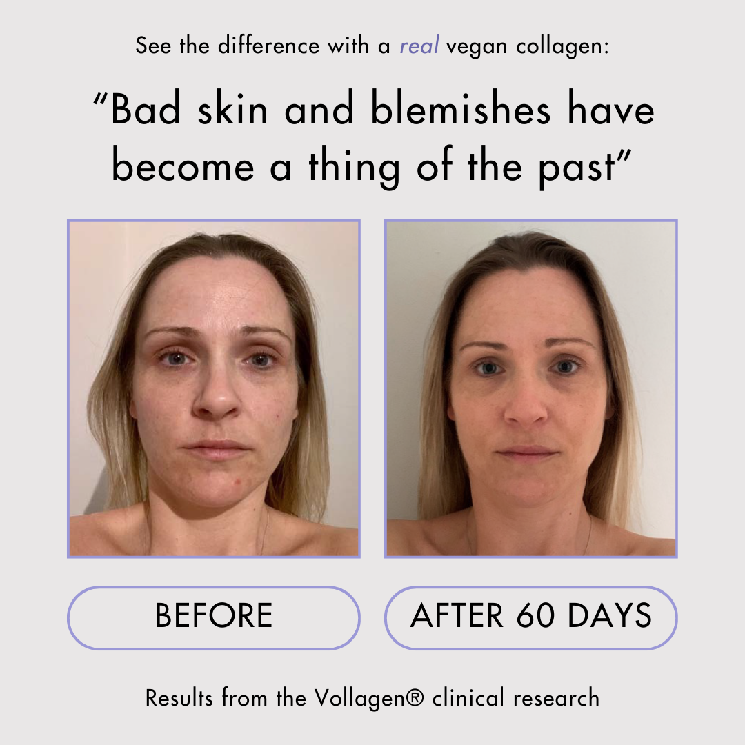 Vegan Collagen Powder 3-Month Supply