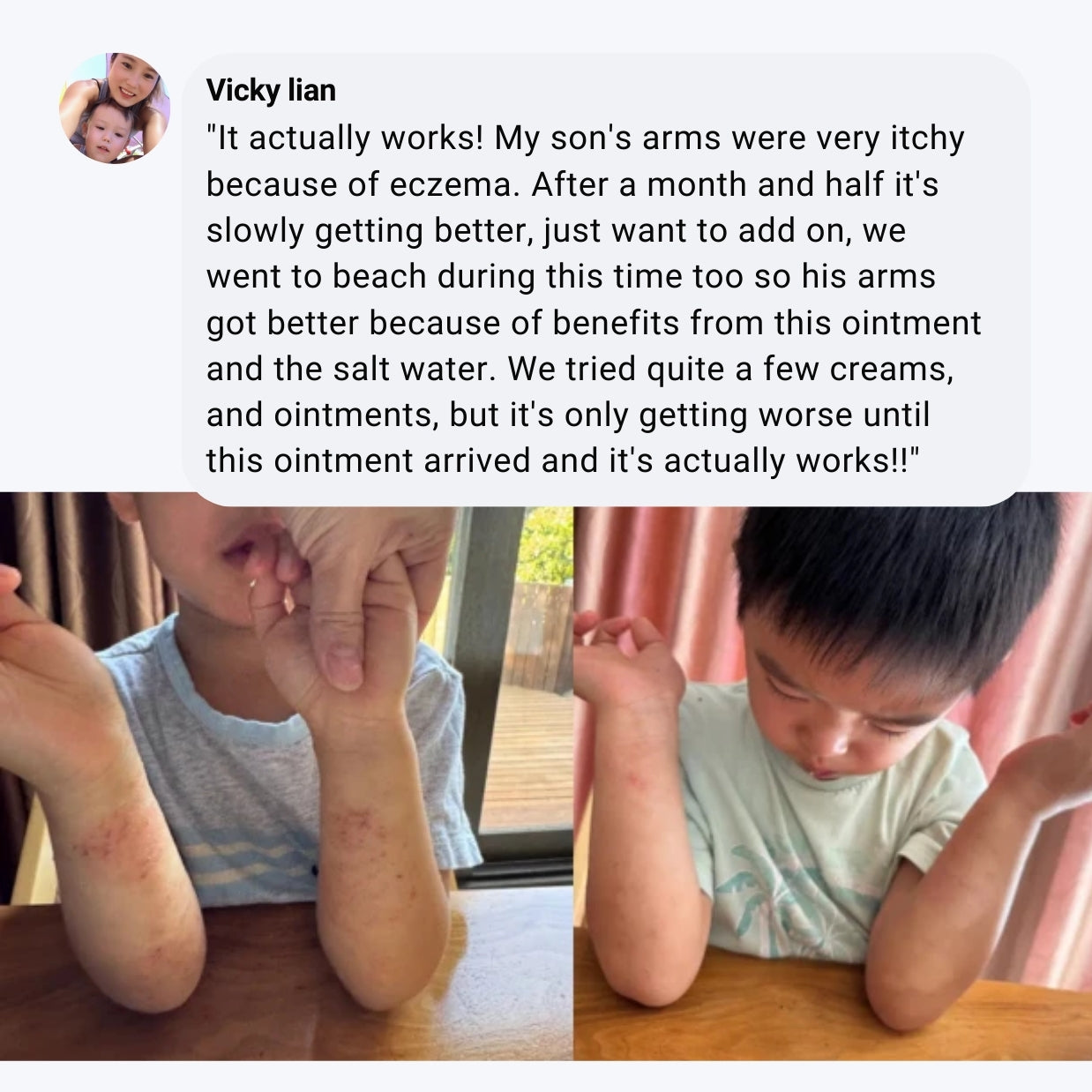Miracle Manuka Duo Pack